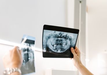 Tooth extractions service image from Riverway Dental
