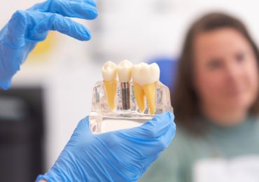 Dental implant service image from Riverway Dental
