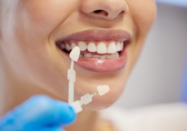 Teeth whitening service image from Riverway Dental